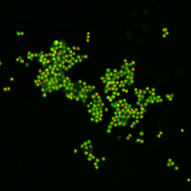 Microscopy image containing fluorescently labelled microbial cells from the model organism Nitrosocosmicus franklandus.