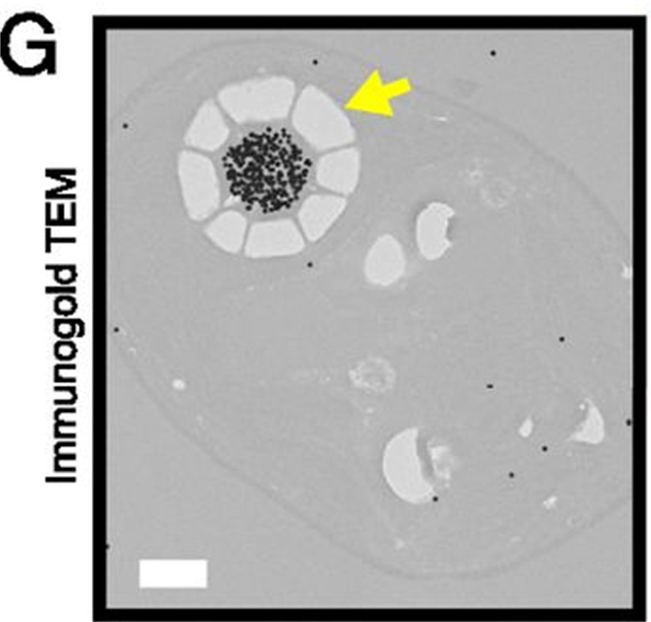 Example of a carbon concentrating pyrenoid from the green alga Chlamydomonas. Rubisco is labelled with gold nanoparticles and is concentrated in a specific site.